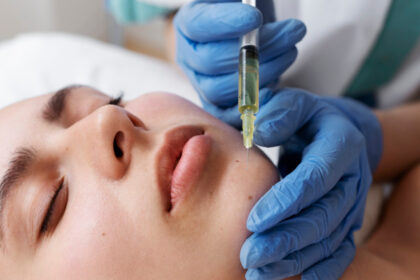 Acide hyaluronique et génioplastie : guide complet pour remodeler le menton