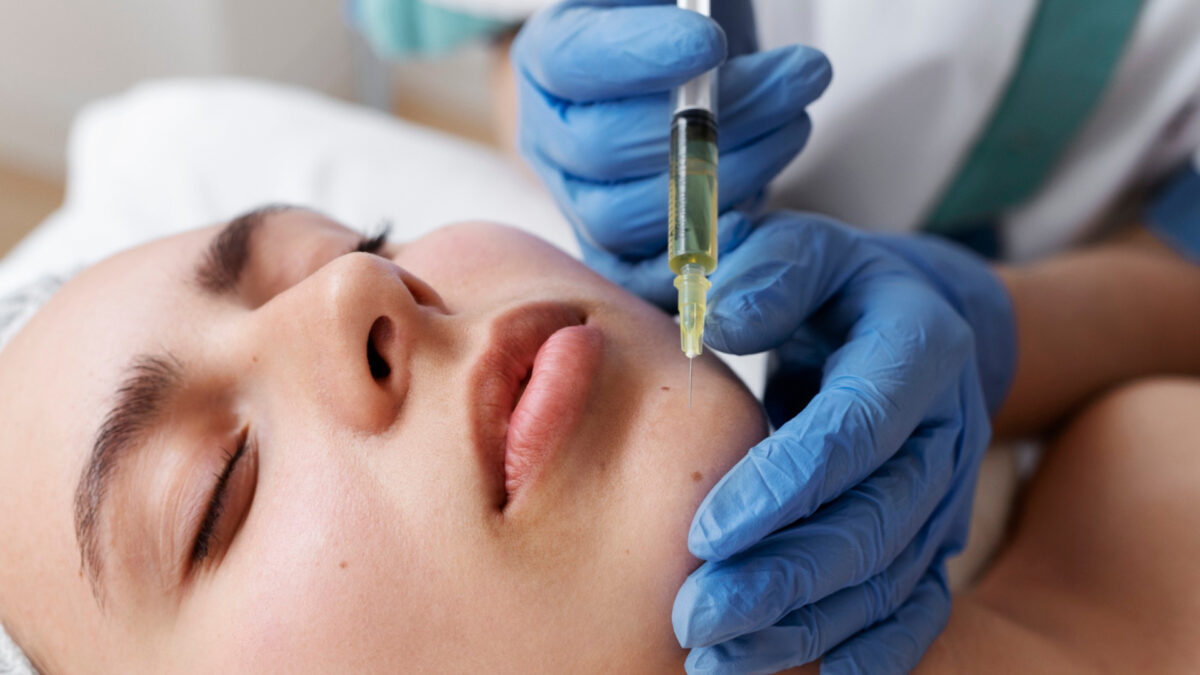 Acide hyaluronique et génioplastie : guide complet pour remodeler le menton
