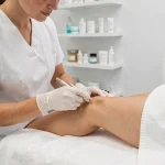 Esthéticienne pratiquant une séance d'électrolyse sur la jambe d'une cliente dans un institut moderne à Montpellier