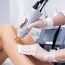 epilation définitive