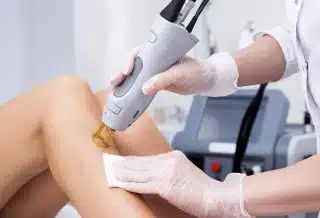 epilation définitive