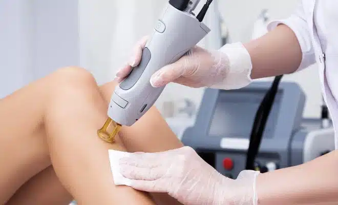 epilation définitive