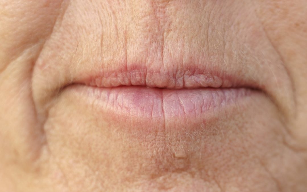 Qu'est-ce que les rides autour de la bouche signifient pour votre santé ...